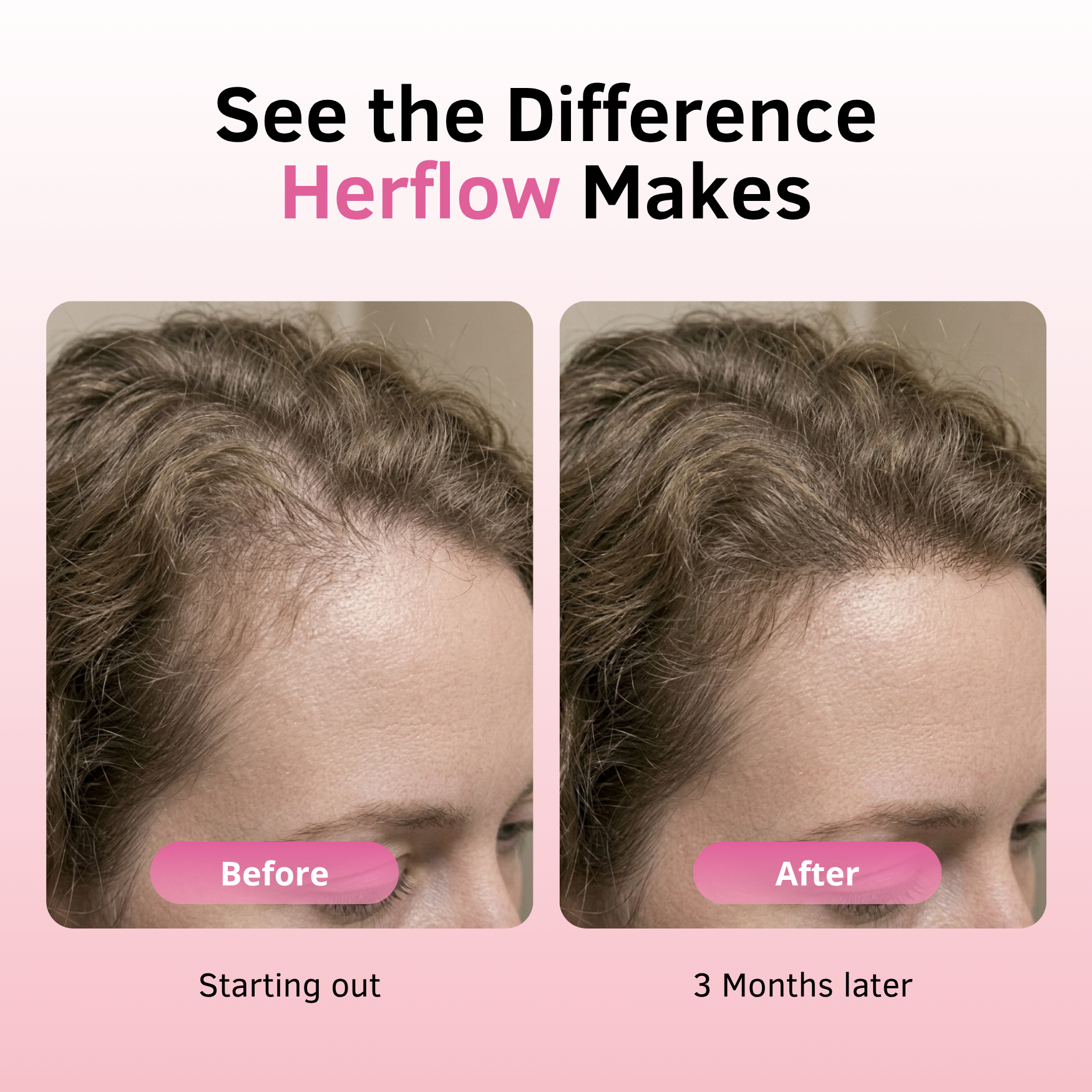 HF Hair Strength
