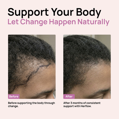 Herflow Hair Strength