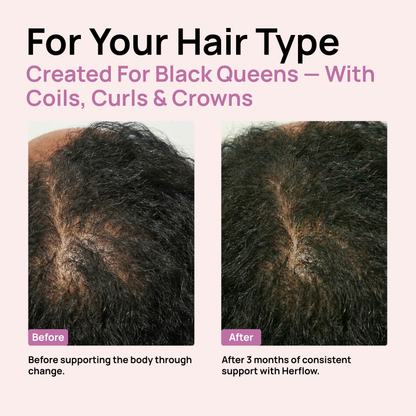 Herflow Hair Strength